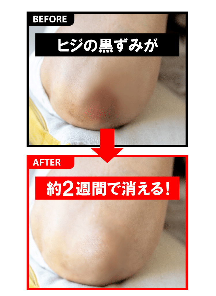 垢すり ミトン タオル  シルク